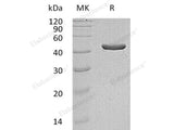 Recombinant Human IDH1 Protein (E.coli, His Tag)