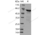 Recombinant Human RELA/Transcription factor p65/NFkB p65 Protein (aa 1-306, GST Tag)