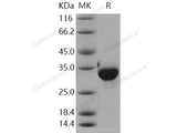 Recombinant Human NQO1/DT-diaphorase Protein (His Tag)