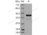 Recombinant Human IKB alpha/NFKBIA Protein (His Tag)