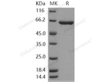 Recombinant Human HEXA Protein (Subunit A, His Tag)(Active)