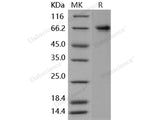 Recombinant Human PTGS2/COX2/PGHS-2 Protein (His Tag)