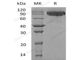 Recombinant Human Butyrylcholinesterase/BCHE Protein (His Tag)(Active)