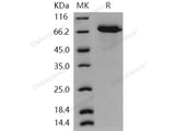 Recombinant Human WFIKKN2/GASP-1 Protein (His Tag)