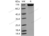 Recombinant Human RET Kinase Protein (His Tag)