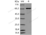 Recombinant Human c-KIT/CD117 Protein (aa 540-972, His & GST Tag)