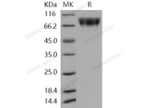 Recombinant Human c-KIT/CD117 Protein (His Tag)(Active)