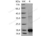 Recombinant Human c-KIT/CD117 Protein (aa 50-190, His Tag)