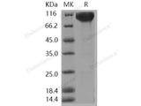 Recombinant Human c-KIT/CD117 Protein (Fc Tag)(Active)