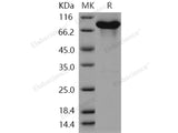 Recombinant Human KEAP1/INRF2 Protein (His & GST & AVI Tag)