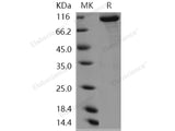 Recombinant Human KEAP1/INRF2 Protein (His & GST Tag)