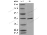 Recombinant Human FANCA/FACA Protein (His Tag)