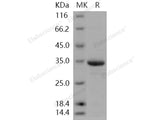 Recombinant Human HIF-1 alpha/HIF1A Protein (His Tag)