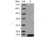 Recombinant Human Beta-2-Microglobulin/B2M Protein (HEK293 Cells, His Tag)