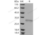 Recombinant Human RPE Protein (His Tag)