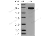 Recombinant Human EphB1/EPHT2 Protein (aa 1-540, His Tag)(Active)