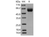 Recombinant Human ROBO4 Protein (His Tag)