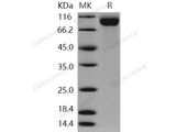 Recombinant Human SIGLEC2/CD22 Protein (aa 176-687, His Tag)