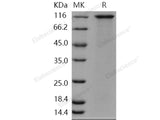 Recombinant Human SorCS1 Protein (His Tag)