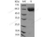 Recombinant Human SLAMF6/Ly108 Protein (aa 1-226, Fc Tag)