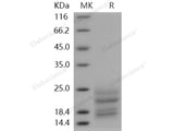 Recombinant Human TNFRSF13B/TACI/CD267 Protein (His Tag)