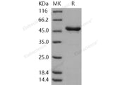 Recombinant Human Tryptophan Hydroxylase 1/TPH1 Protein (His Tag)