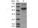 Recombinant Human DMP1 Protein (His Tag)(Active)