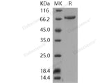 Recombinant Human TGM3/Transglutaminase 3 Protein (His Tag)(Active)