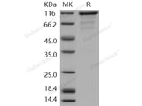 Recombinant Human CASK Kinase Protein (His & GST Tag)