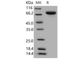 Recombinant Human XPNPEP2 Protein (His Tag)(Active)