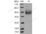 Recombinant Human CLEC12A/CLL-1/DCAL2 Protein (His Tag)