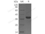 Recombinant Human C1QBP Protein (aa 75-282, His Tag)