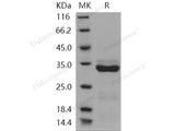 Recombinant Human Trypsin-3/PRSS3 Protein (His Tag)(Active)