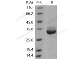 Recombinant Human Kallikrein 4/KLK4 Protein (His Tag)(Active)