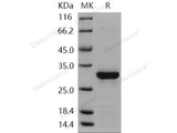 Recombinant Human Caspase-14/CASP14 Protein (His Tag)(Active)