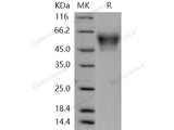 Recombinant Human NRXN3 Protein (His Tag)(Active)