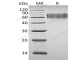 Recombinant Human LYPD3 Protein (His Tag)