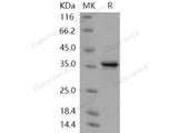 Recombinant Human TWF1/Twinfilin-1 Protein