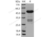 Recombinant Human TWF1/Twinfilin-1 Protein (His & GST Tag)