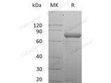 Recombinant Human SIRP gamma/CD172g Protein (His Tag)(Active)