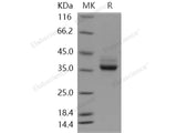 Recombinant Human CSAGE/CSAG1 Protein (Fc Tag)