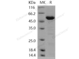 Recombinant Human HDAC4 Protein (aa 612-1084)