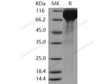 Recombinant Human SIGLEC5 Protein (Fc Tag)