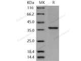 Recombinant Human COL2A1 Protein (aa 1242-1487, His Tag)