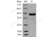 Recombinant Human CALML5/CLSP Protein (His & GST Tag)