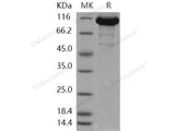 Recombinant Human ACLY/acly/ATP citrate lyase Protein (His Tag)