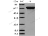 Recombinant Human SEMA4A/Semaphorin B Protein (His Tag)(Active)