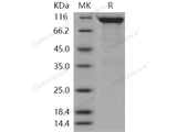 Recombinant Human SEMA4A/Semaphorin B Protein (Fc Tag)(Active)