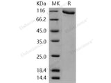 Recombinant Human GRK2/ADRBK1 Protein (His & GST Tag)