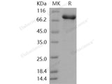 Recombinant Human STXBP1/UNC18A Protein (His & GST Tag)